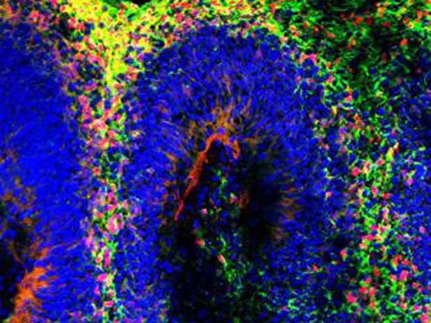  Imagem de minicérebro mostra diferentes estruturas que mimetizam cérebro humano: estrutura é usada para testar drogas (Foto: UC San Diego Health)