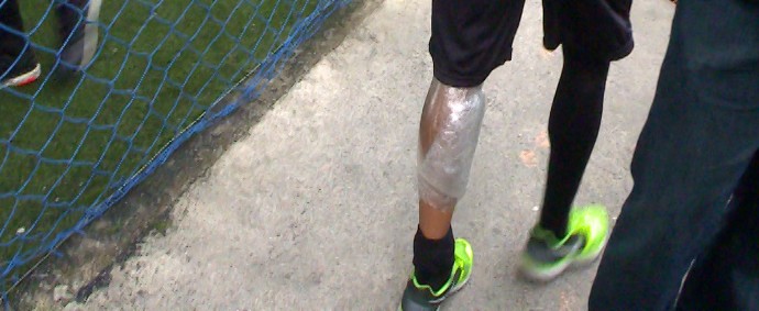 Douglas Santos deixa treino do Atlético-MG com proteção na perna esquerda (Foto: Maurício Paulucci)