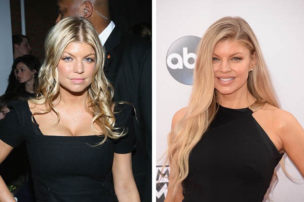 Fergie em 2007 e agora (Foto: Getty Images)