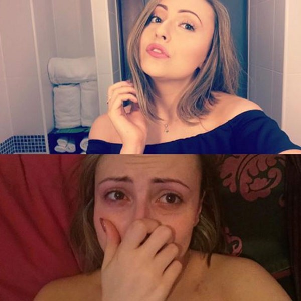 Amber Smith tem depressão e crise de ansiedade desde os 16 anos (Foto: Reprodução/ Facebook)