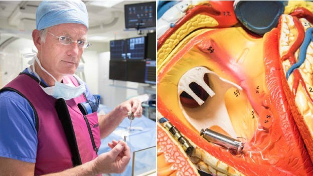 Procedimento pioneiro implanta 'menor marca-passo do mundo'