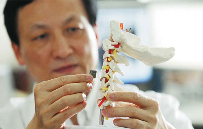 Primeira vértebra impressa em 3D foi implantada com sucesso em paciente com câncer na coluna (Reprodução/Forbes)