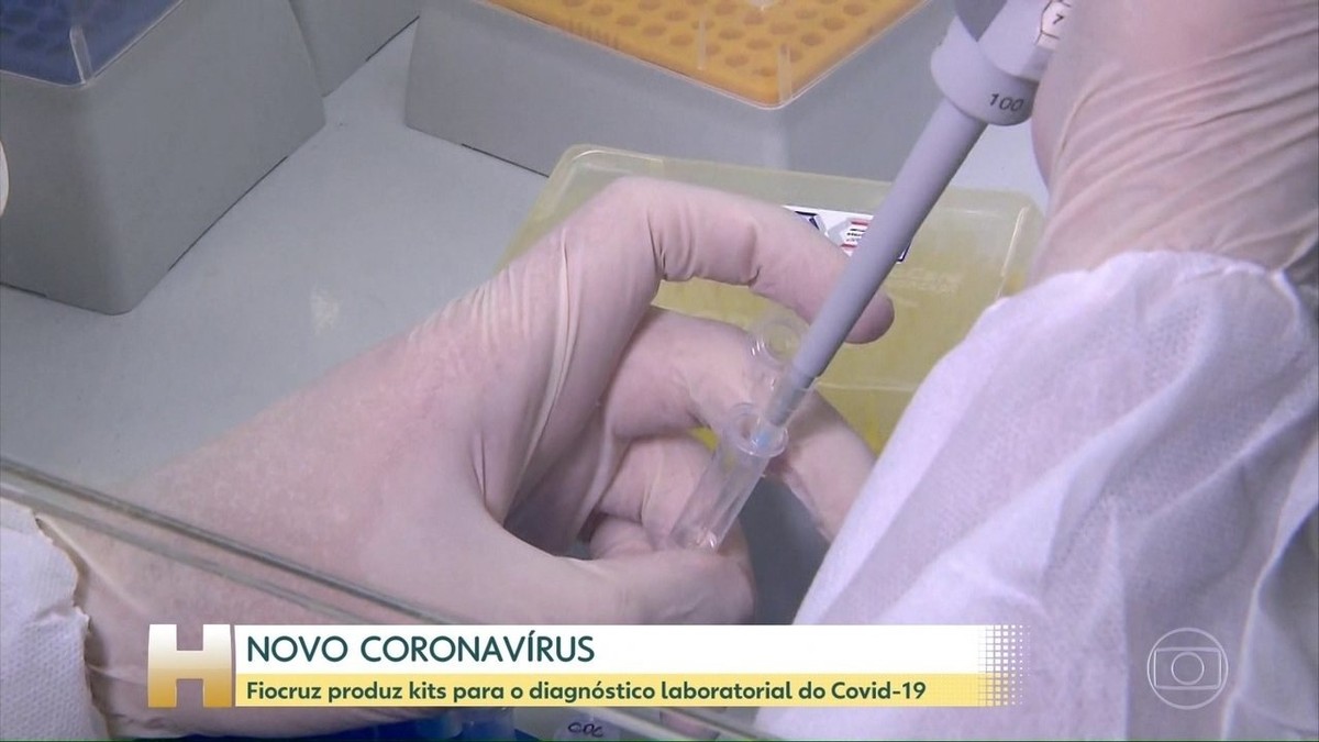 Fiocruz desenvolve kit para detecção do novo coronavírus em 20 dias