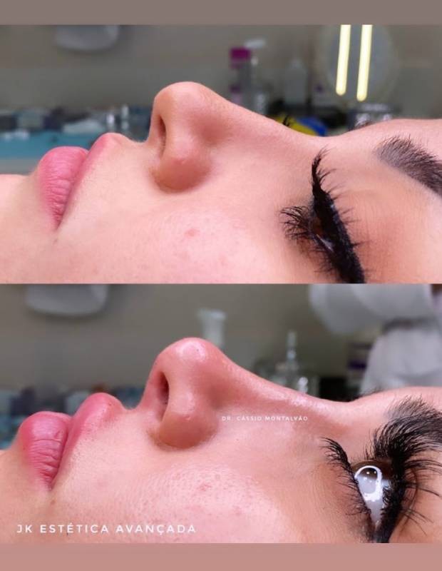 Bianca Andrade antes e depois (Foto: Reprodução/Instagram) Bianca Andrade antes e depois (Foto: Reprodução/Instagram)
