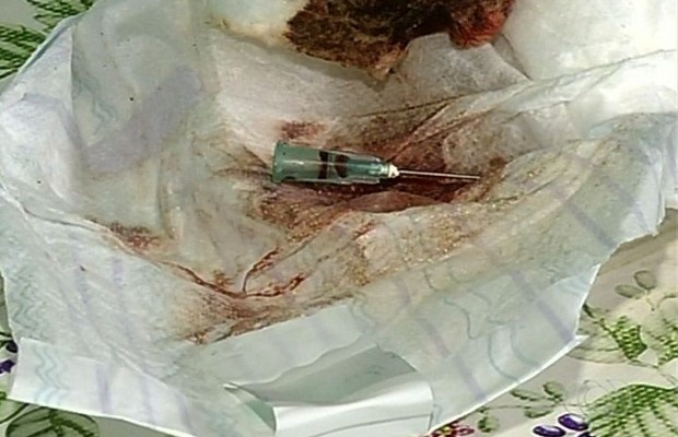 Mãe encontra agulha em corpo de bebê após injeção, Itumbiara, Goiás (Foto: Reprodução/TV Anhanguera)