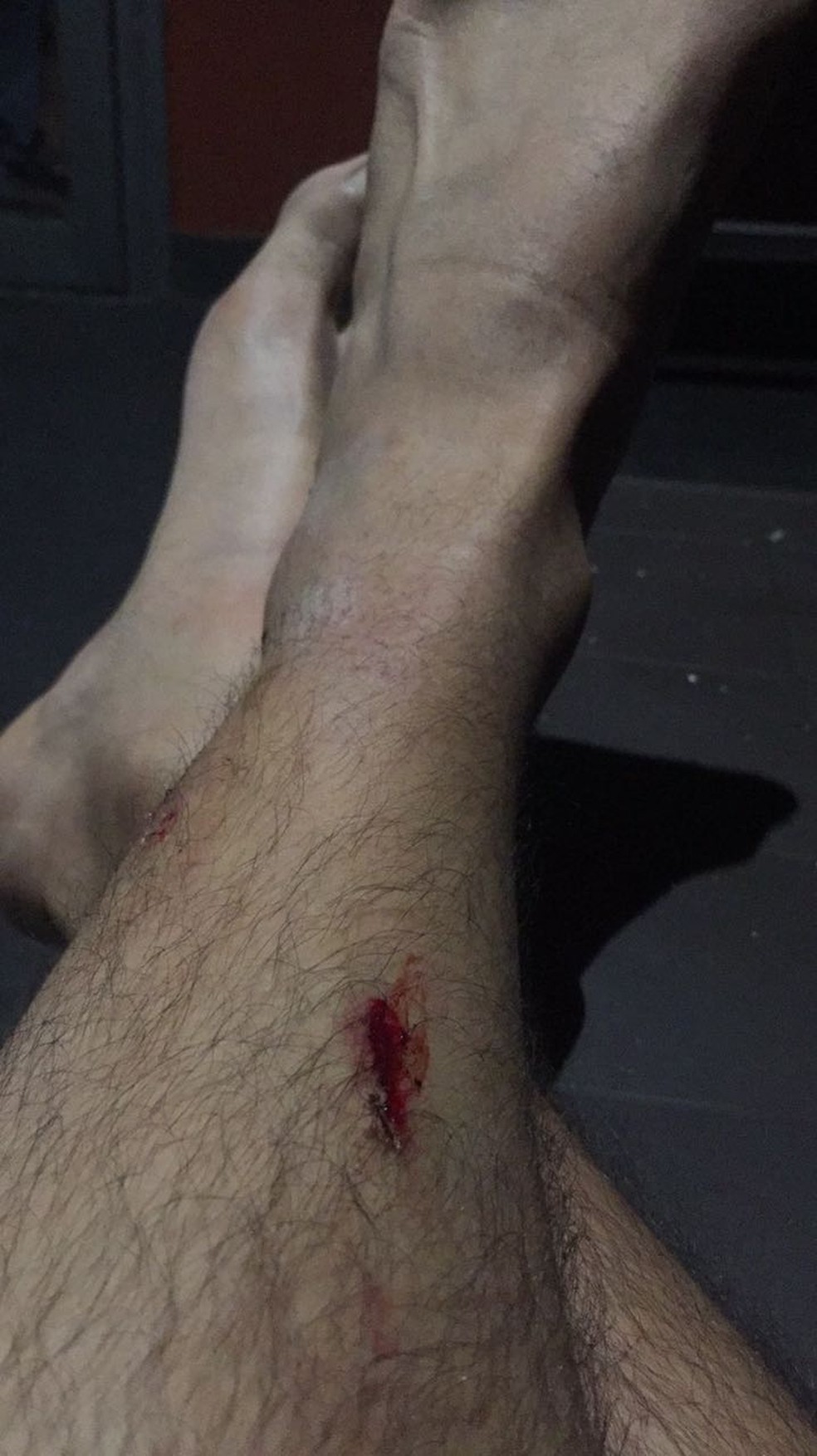 Ferimentos de Victor Bastos durante confusão em Turim (Foto: Victor Bastos )