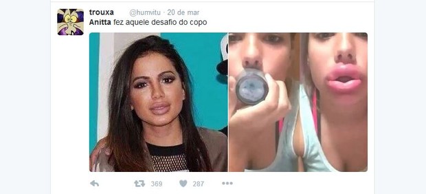 Anitta vira meme na web após preenchimento labial (Foto: Reprodução/Twitter)