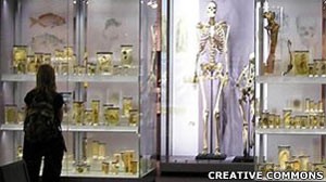 Esqueleto de Charles Byrne é exibido no Royal College of Surgeons em Londres (Foto: Creative Commons/BBC)
