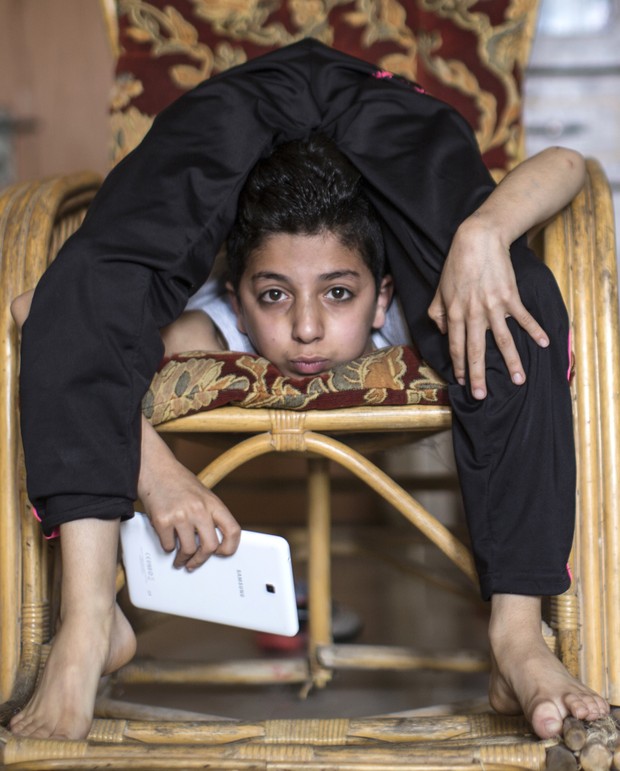Mohammed al-Sheikh consegue dobrar o corpo em posições impossíveis para a maioria das pessoas (Foto: Mahmud Hams/AFP)