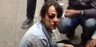 Repórter ferida no protesto 
em SP tem alta (Diego Zanchetta/Estadão Conteúdo)