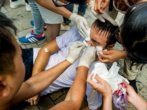 Pessoas limpam o rosto de um ativista depois de ter sido pulverizado com spray de pimenta. (Foto: Xaume Olleros / AFP Photo)