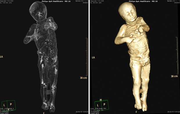Montagem mostra tomografia computadorizada de garoto que devia ter 4 anos quando morreu devido à erupção do Vesúvio em Pompeia  (Foto: Ercolano e Stabia/Handout via Reuters)