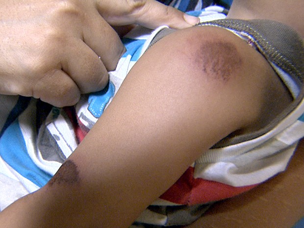 Criança foi arremessada para fora de carro durante assalto em Campinas (Foto: Reprodução / EPTV)