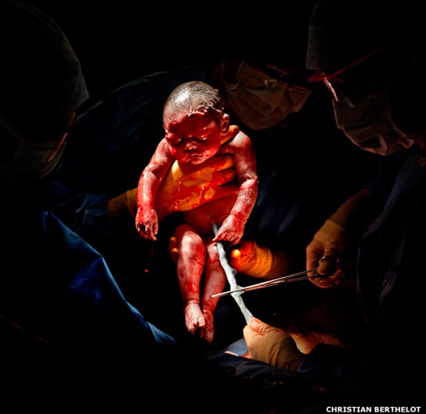 Liza, 26 de fevereiro de 2013, 8h45, 3,2 quilos, 3 segundos depois do nascimento (Foto: Christian Berthelot) Liza, 26 de fevereiro de 2013, 8h45, 3,2 quilos, 3 segundos depois do nascimento (Foto: Christian Berthelot)