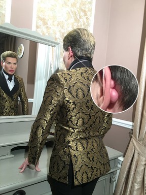 Ego Rodrigo Alves O Ken Humano Refaz O Rosto E Admite Nao Aceito Envelhecer Noticias De Famosos