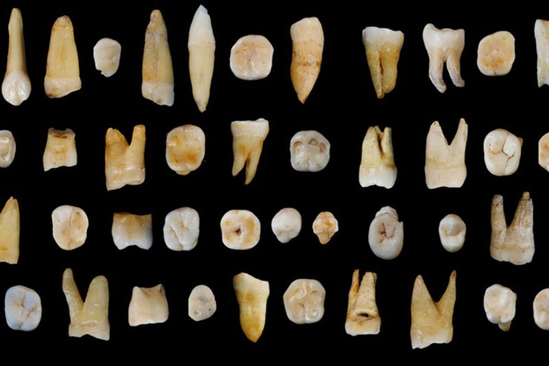 Foram encontrados 47 dentes de 13 humanos na China (Foto: Reprodução/S. Xing e X-J. Wu)