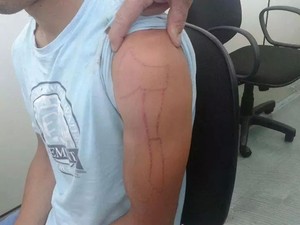 Homem tinha feito machadinha no próprio corpo, segundo a polícia. (Foto: Divulgação/Polícia Civil)