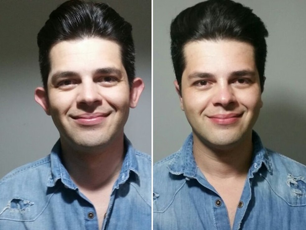 Eugênio Aquino, 33 anos, conseguiu cirurgia por meio do Projeto Orelinha em Goiânia, Goiás (Foto: Reprodução/Arquivo pessoal)