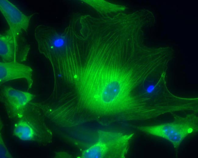 célula 1 (Foto: Julie Baker/Stanford University School of Medicine/California Institute for Regenerative Medicine/Handout/Reuters)
