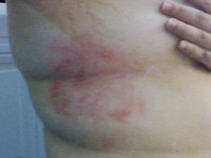 Jovem ficou com marcas de agressão pelo corpo (Foto: Arquivo Pessoal)