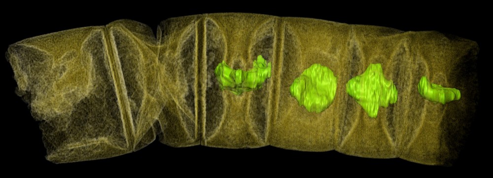 Raio-x de algas vermelhas como fósseis, tingidas para mostrar detalhes, pode representar as plantas mais antigas da Terra (Foto: Courtesy Stefan Bengtson/Handout via REUTERS )
