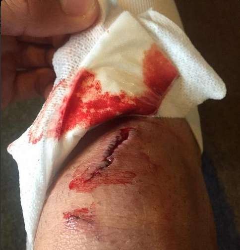 Joelho De Pena Colazo Boca Juniors Nacional
