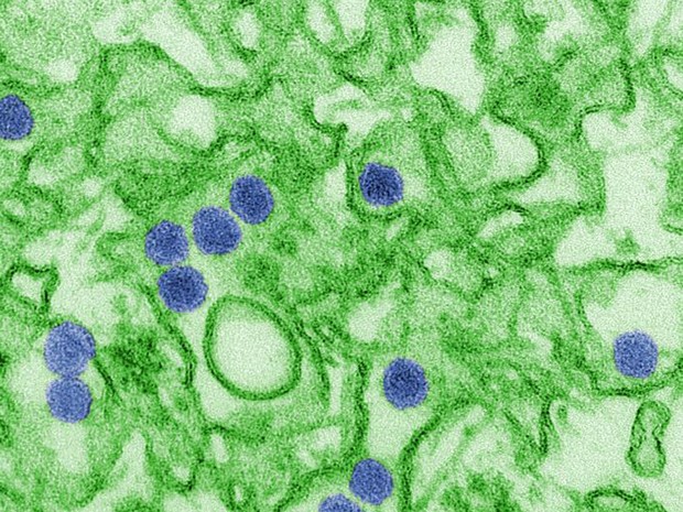  Imagem de micrografia eletrônica de transmissão colorida digitalmente mostra o vírus da zika  (Foto: CDC/ Cynthia Goldsmith)