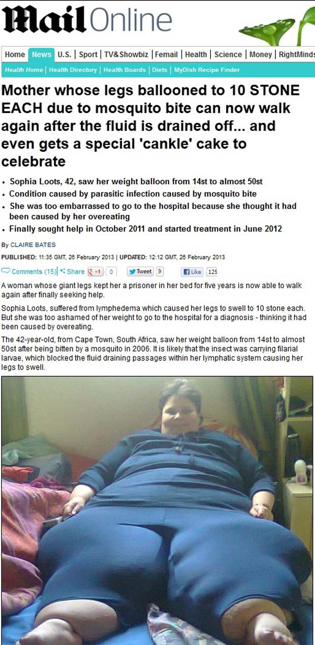 Sophia Loots chegou a ter mais de 60 kg em cada perna (Foto: Reprodução/Daily Mail)