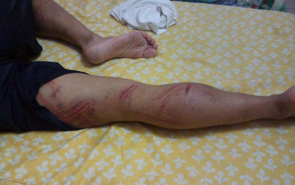 Perna de soldado ficou machucada após agressão (Foto: Arquivo Pessoal) Perna de soldado ficou machucada após agressão (Foto: Arquivo Pessoal)