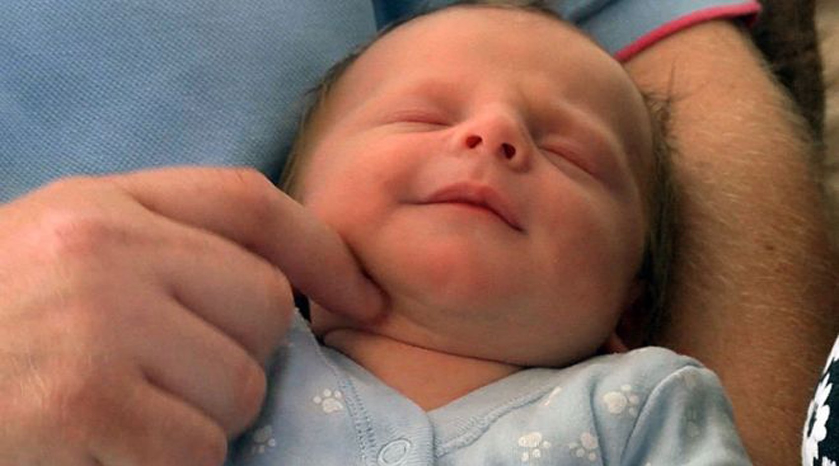  Teddie passou cinco meses "escondido" no útero da mãe  (Foto: BBC)