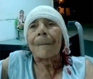 Mesmo com sangramento na cabeça, idosa não foi atendida na UPA de Pajuçara (Foto: Cícero)