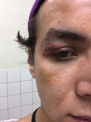 Fotógrafo André Ligeiro acusa ator Caio Castro de agressão em festa na Bahia (Foto: Ali Karakas)