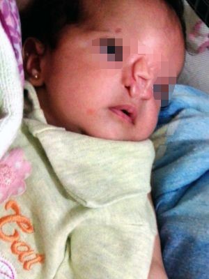 Isis nasceu em Santos com uma m formao no nariz (Foto: Arquivo Pessoal)