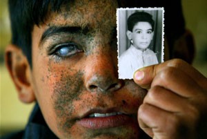 O menino Ayad posa com a foto que o retrata ainda antes do bombardeio (Foto: Mauricio Lima)