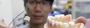 Prótese dentária envia dados a pesquisadores (Reuters/Pichi Chuang)