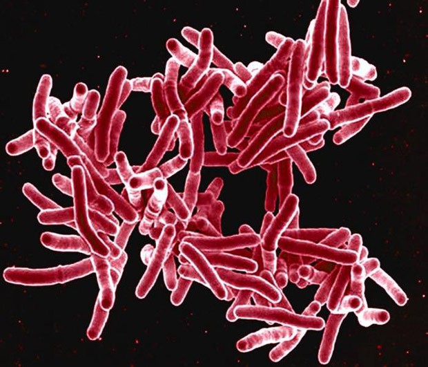   Imagem de microscopia eletrônica  mostra a bactéria Mycobacterium tuberculosis, que provocam tuberculose  (Foto: National Institute of Allergy and Infectious Diseases (NIAID))