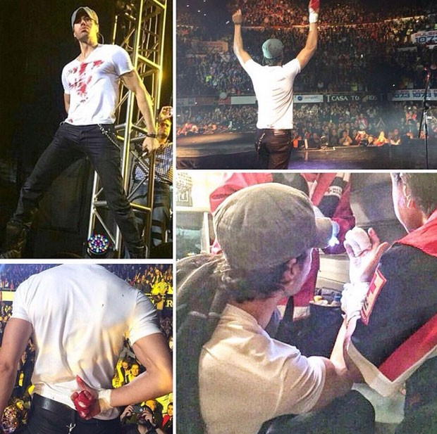 Fotos publicadas em rede social pelo agente de Enrique Iglesias mostram o cantor ferido ao tentar pegar drone durante o show (Foto: Reprodução/Instagram/Joe Bonilla)