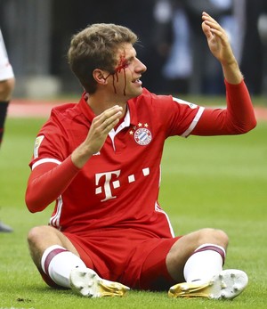 Thomas Müller ensanguentado em Eintracht Frankfurt x Bayern de Munique (Foto: REUTERS/Kai Pfaffenbach)