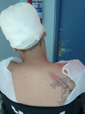 Torcedor ferido em briga entre corintianos e palmeirenses em Guarulhos (Foto: Reprodução/Arquivo Pessoal)