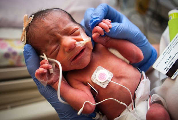 quintuplos3 Quíntuplos nascem em hospital de Utah, nos EUA