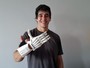Com impressora 3D em casa e R$ 10, brasiliense faz próteses para crianças