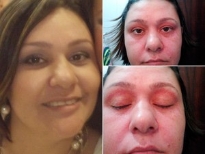 Imagens da vendedora antes e depois de consumir Ades, segundo ela (Foto: Arquivo Pessoal)