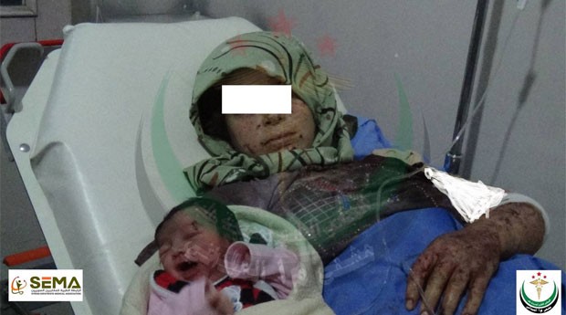 Mulher deu à luz após ficar ferida em um bombardeio em Aleppo, na Síria (Foto: Reprodução/Facebook/M1hospital)