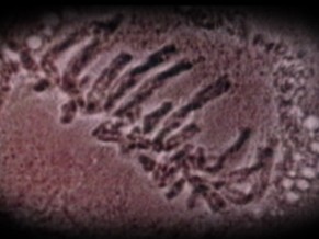 Células-tronco (Foto: Reprodução de TV)