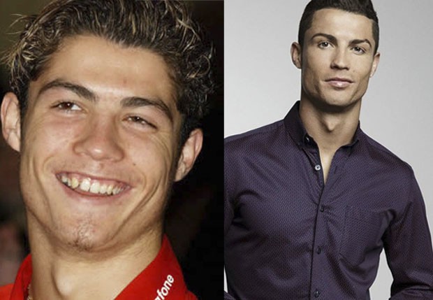 Cristiano Ronaldo antes e depois (Foto: Reprodução/Instagram)