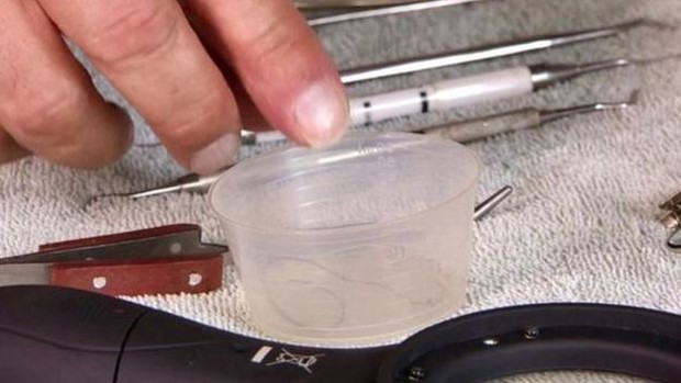 Paciente adaptou instrumentos a partir de materiais cedidos por dentista  (Foto: BBC)