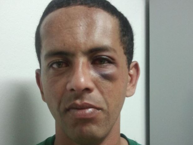 Homem diz ter sido agredido por pastor em Jacareí (Foto: Camilla Motta/G1)