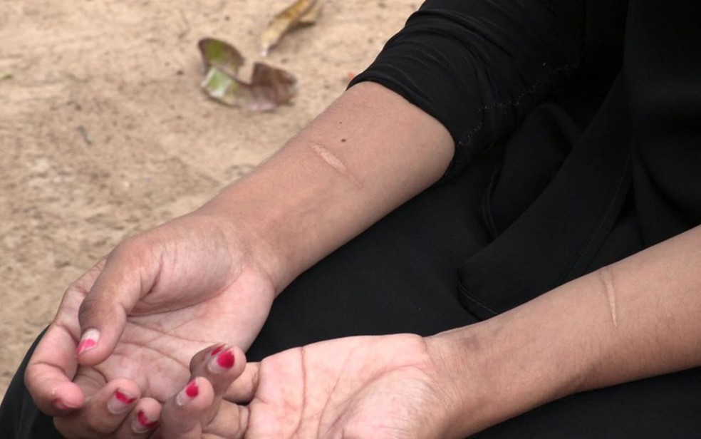 Shafa tem cicatrizes nos pulsos, lembrança de uma tentativa de suicídio (Foto: BBC)