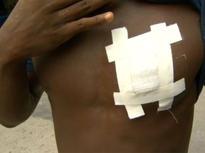 Chauan foi baleado no peito e sobreviveu, desmentindo a versão da PM (Foto: Reprodução / TV Globo)