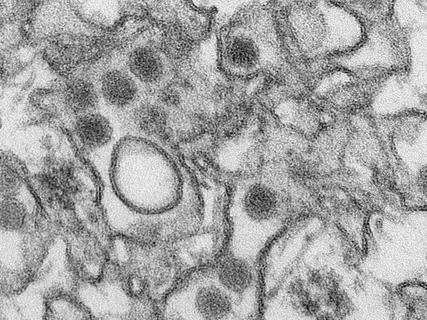  Imagem divulgada pelos Centros de Prevenção e Controle de Doença dos Estados Unidos (CDC) feita com microscópio eletrônico de transmissão (MET) mostra o zika vírus  (Foto: Reuters/CDC/Cynthia Goldsmith)